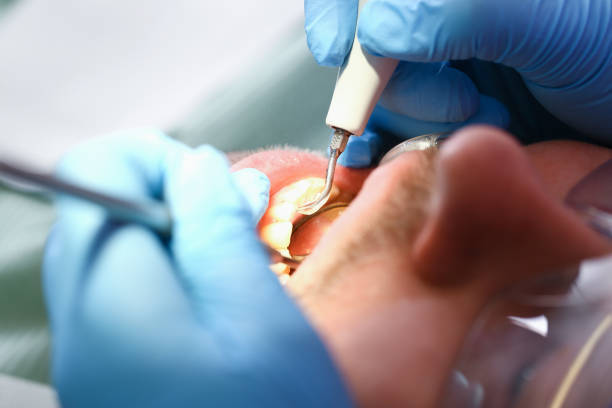 Best After-Hours Dental Trauma Care in Mount Gilead, OH