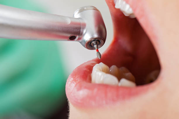 Best Weekend Emergency Dentist in Mount Gilead, OH